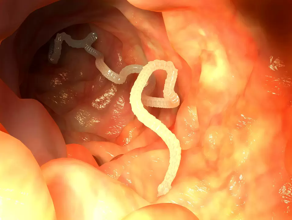 human esophageal parasitic worms