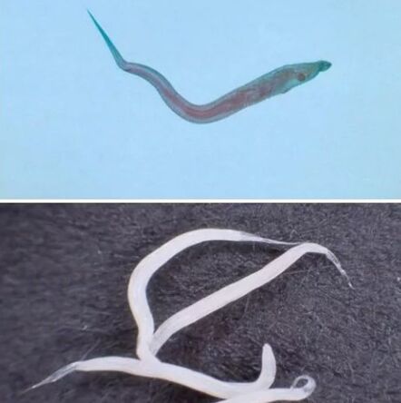 The type of parasites in the human body