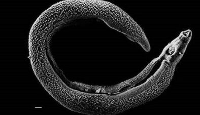 What parasites can live in one's heart