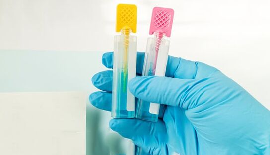 Parasitic diagnostic method