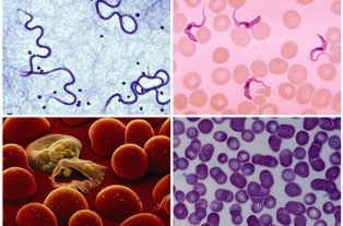 parasites what can be found in human blood
