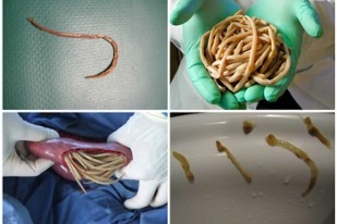 parasites what can live in the human intestine